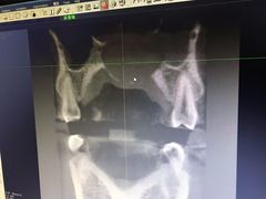 -哈尔滨医科大学附属第一医院(南岗院区)