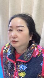 点击看大图 体验后-重庆联合丽格第五医疗美容医院