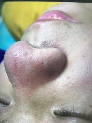 点击看大图 -蕾特恩专业祛痘·皮肤管理