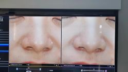 -苑苑vbeauty科技美容SPA