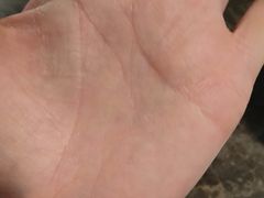 -祖传修脚甲沟炎灰指甲鸡眼