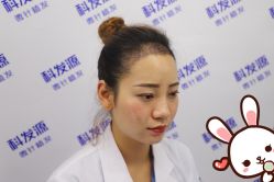 -大麦微针植发丨全国连锁