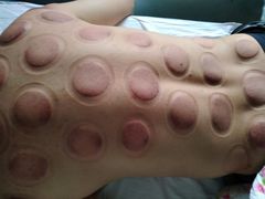 -润伊康·正骨推拿·盲人按摩(南横东街店)