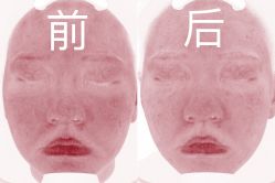 -深圳芙必优医疗美容·抗衰中心