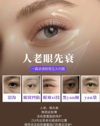 -克丽缇娜