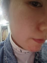 体验前-SKINIST丽铂医疗美容