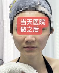 体验后-深圳阳光医疗美容医院·旗舰店