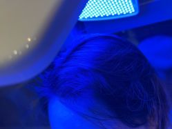 -碧莲盛·不剃发植发