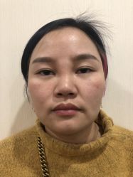 -上海玫瑰医疗美容医院