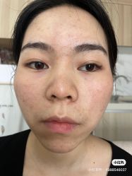 -skin79皮肤管理基站