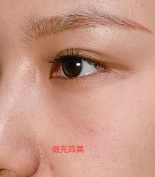 -东莞缔美美容医院