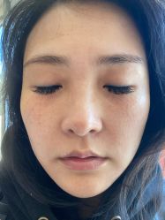 -叶美人医疗美容