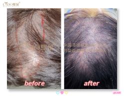 -熙朵美学植发·连锁品牌