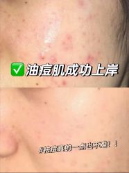 -SKIN79皮肤管理中心