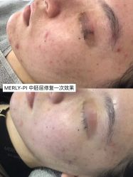 -MLP美丽派·问题肌疗愈中心