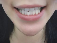 -Dr.Z dental仁康种植矫正中心