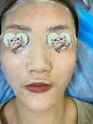 -广州健丽·去眼袋医疗美容机构