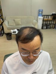 点击看大图 -极客侠男士假发定制补发