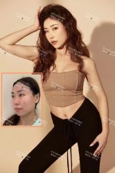 -北京米扬丽格医疗美容·联合丽格鼻整形中心