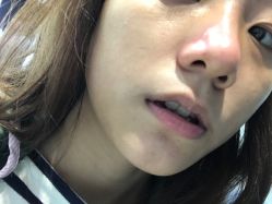 -Yestar宁波艺星整形医院