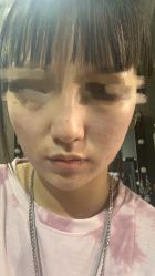 -北京丽星翼美医疗美容