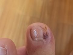 -足护氏采耳修脚(七克拉店)