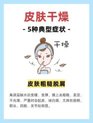 -克丽缇娜