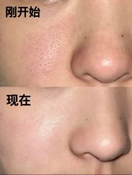 -SKIN79皮肤管理中心