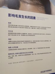 -碧莲盛不剃发植发