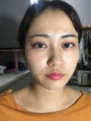 -广东韩妃整形外科医院