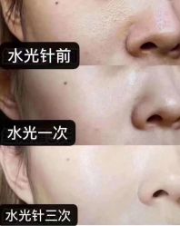 -上海漾颜医疗美容