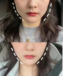 -深圳阳光医疗美容医院·旗舰店