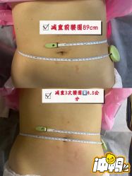 -Fundi张玉珊修身堂·indiba·BTL科技瘦身