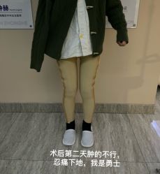 体验后-上海首尔丽格医疗美容医院