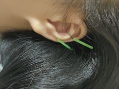 -上海永慈康复医院