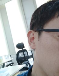 -八大处整形