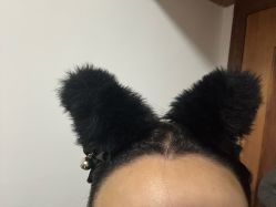 体验后-大麦微针植发全国连锁