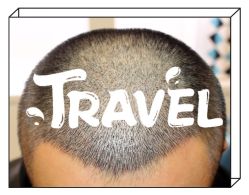 -大麦微针植发全国连锁