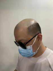 -发饰美男士增发补发假发定制店