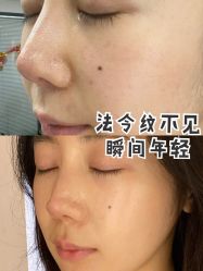 -厦门美莱整形美容医院