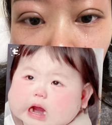 -成都西区医院整形美容