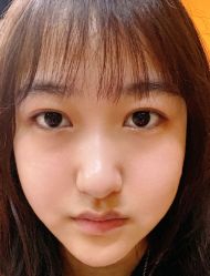 点击看大图 -丰联丽格医疗美容·联合丽格眼整形中心