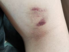 -深圳大学总医院