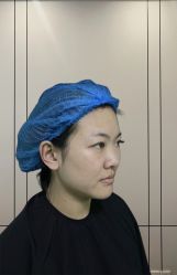 体验前-沈阳名流美容医院