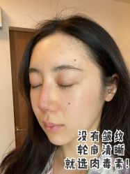 -厦门美莱整形美容医院