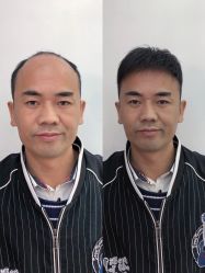 -发饰美男士增发补发假发定制店