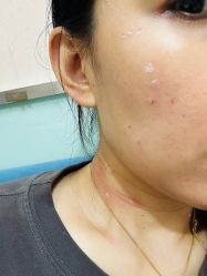 -北京美痣堂古方祛痣斑疣瘊
