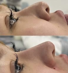 -郡艺医疗美容·微整·眼鼻吸脂