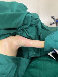 -洁铭新加坡医美