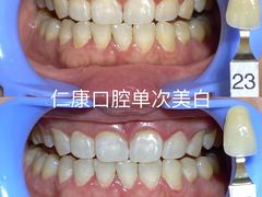 -Dr.Z dental仁康种植矫正中心